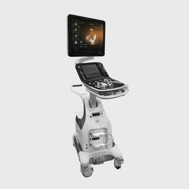 Cardiac ultrasound diagnostic system